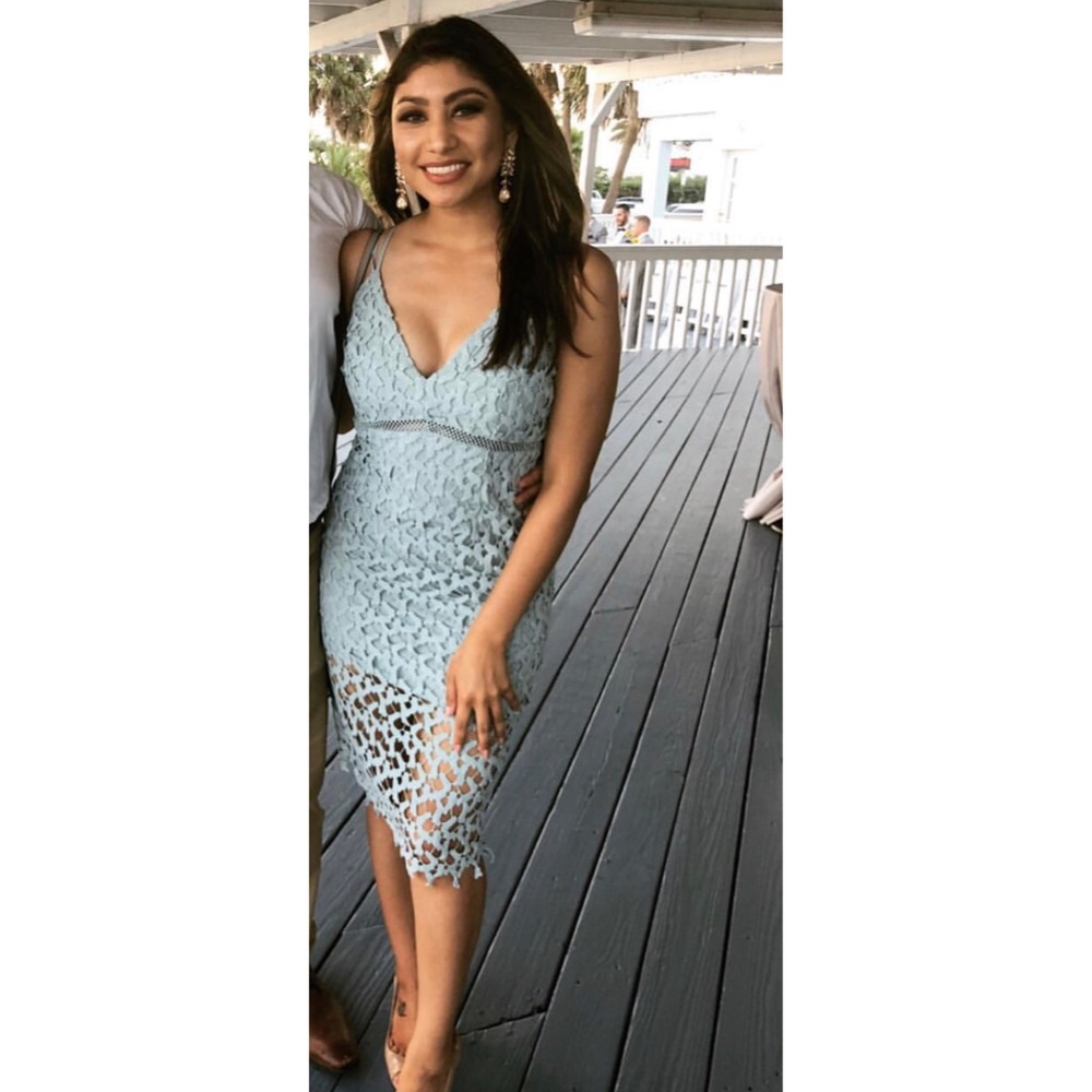 Aqua Lace Midi Dress 👗✨